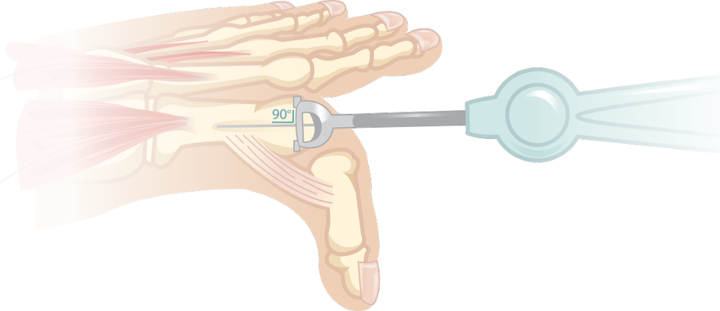 toe pain