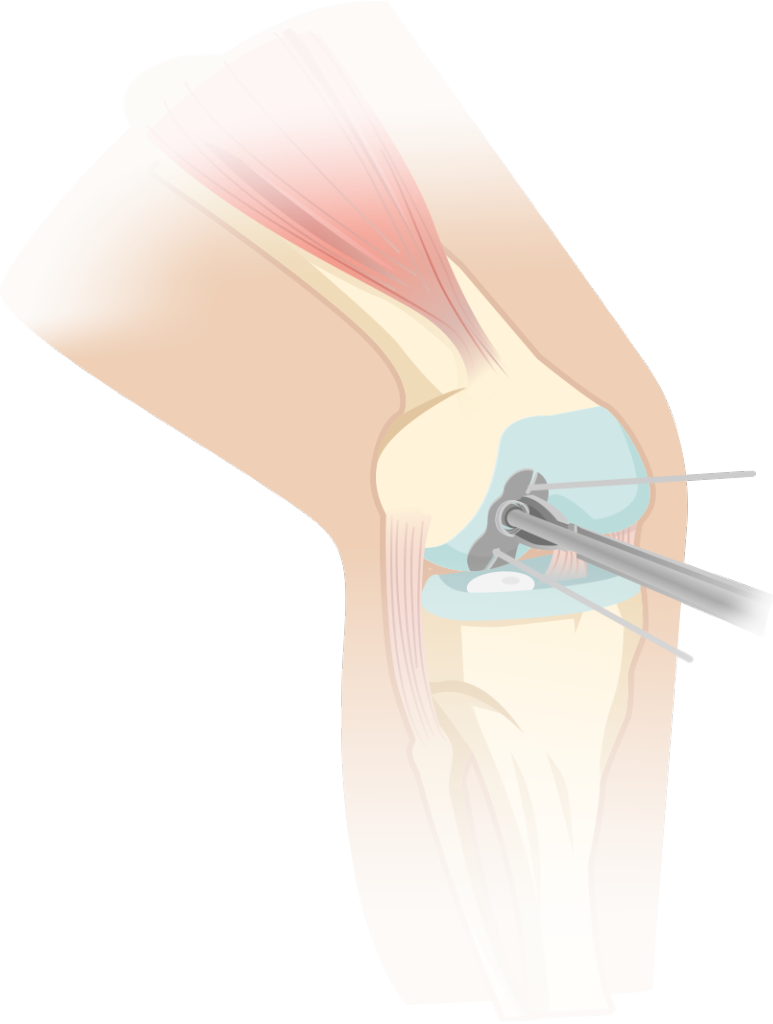 right shoulder pain