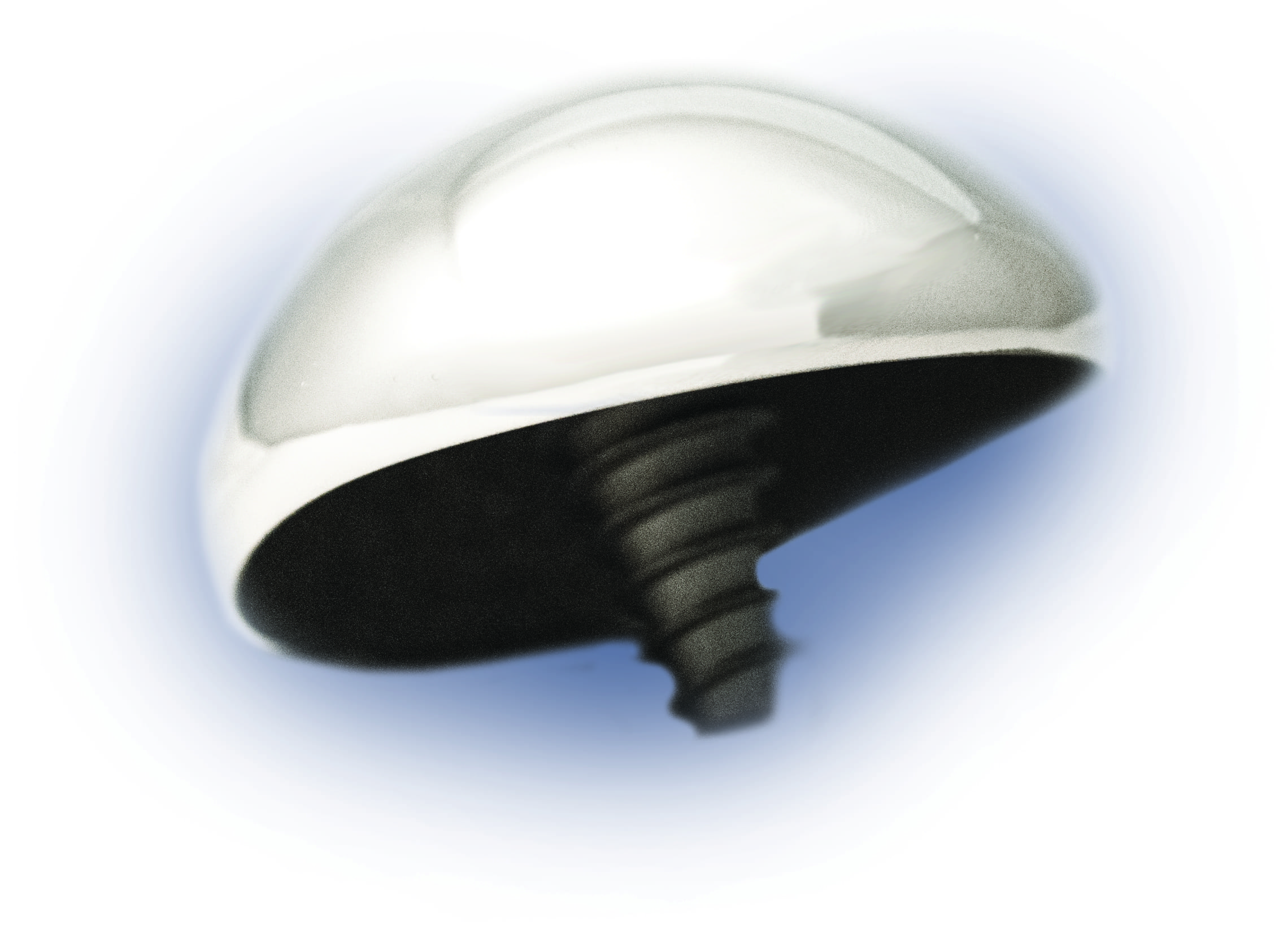 shoulder implant surgery