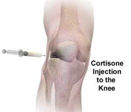 Steroid injection in wrist side effects