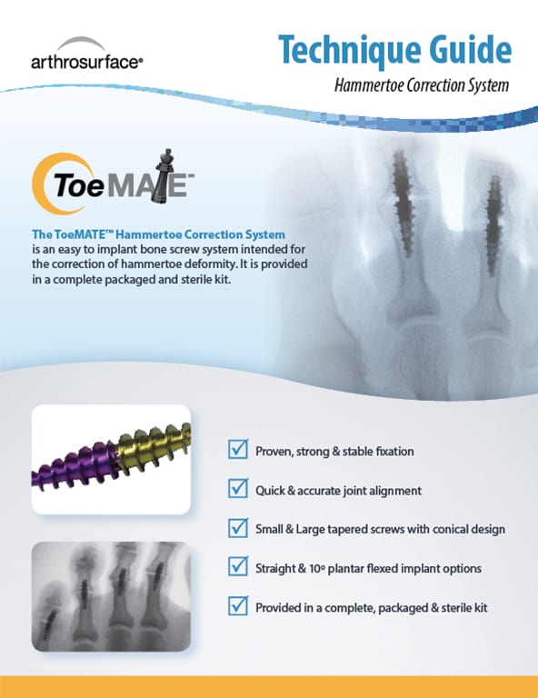 ToeMATE Tech Guide