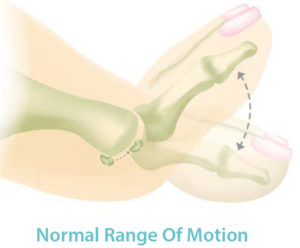 toe pain