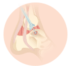 foot pain relief