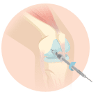 knee injuries