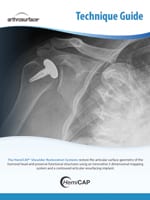 HemiCAP Shoulder Technique Guide
