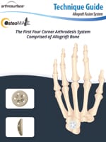 Shoulder Brochure