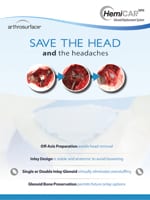 Glenoid One Pager