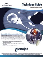 Glenojet Tech Guide