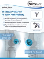 Patello Femoral One Pager