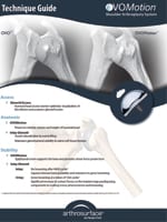 OVO Stemless Total Shoulder W/ Glenoid Tech Guide