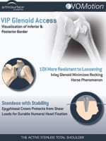 Glenoid One Pager